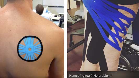Correct Kinesio Tape Application.