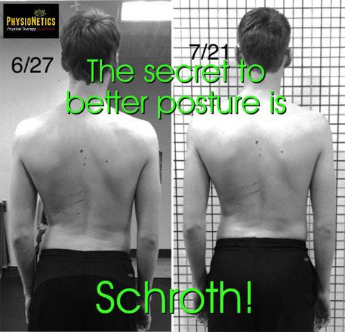 Chart showing Improved Scoliosis with Schroth Method Therapy.